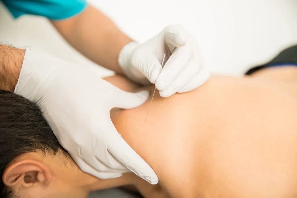 needling